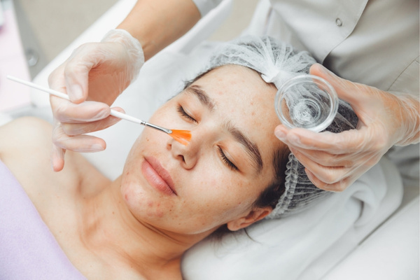Mỗi hoạt chất peel có cơ chế và tốc độ đẩy mụn khác nhau