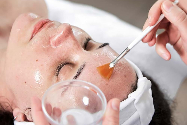 Peel da trị mụn giúp loại bỏ tế bào hư tổn, gom cồi mụn và cải thiện làn da sáng khỏe