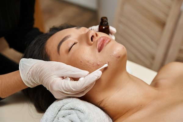 Review trị mụn ở bệnh viện Da Liễu TPHCM về quy trình, chi phí và thời điểm khám phù hợp
