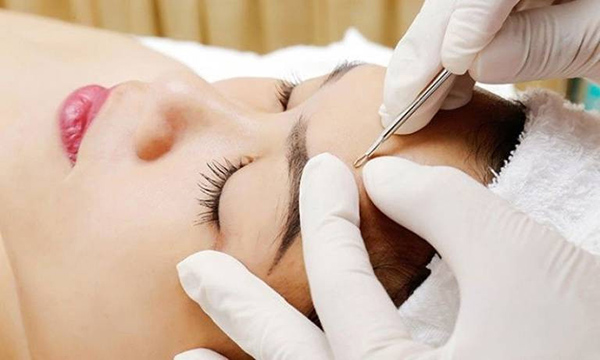 Kỹ thuật lấy nhân mụn chuẩn y khoa với dụng cụ vô khuẩn