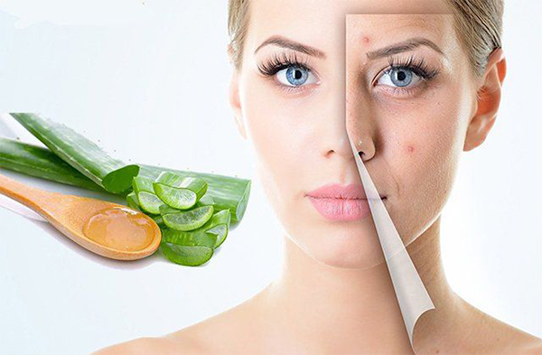 Hướng dẫn cách trị mụn ẩn bằng nha đam tươi giúp làm dịu và cấp ẩm cho da