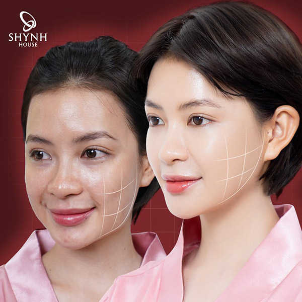 Tư vấn sử dụng hoạt chất và thuốc điều trị nám da theo phác đồ cá nhân hóa