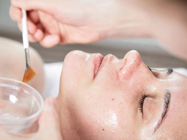 Peel da hóa học hỗ trợ cải thiện nám mảng, làm sáng da và thúc đẩy tái tạo bề mặt da