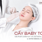 Cấy Baby Tox – Giải pháp chăm sóc và cải thiện làn da tại Shynh Medical Clinic