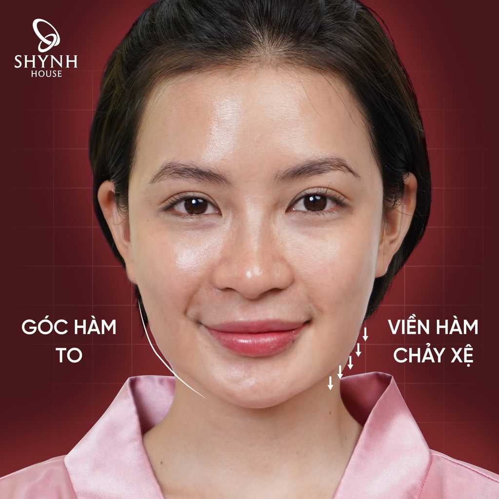 Dấu hiệu da phù hợp với liệu trình nâng cơ trẻ hóa da Hi-Trulift Pro