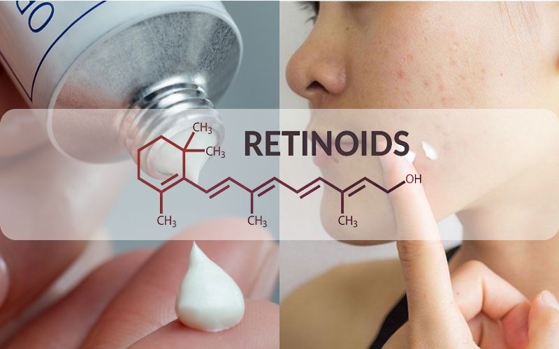 Điều trị mụn viêm sớm bằng thuốc kháng sinh/retinoid