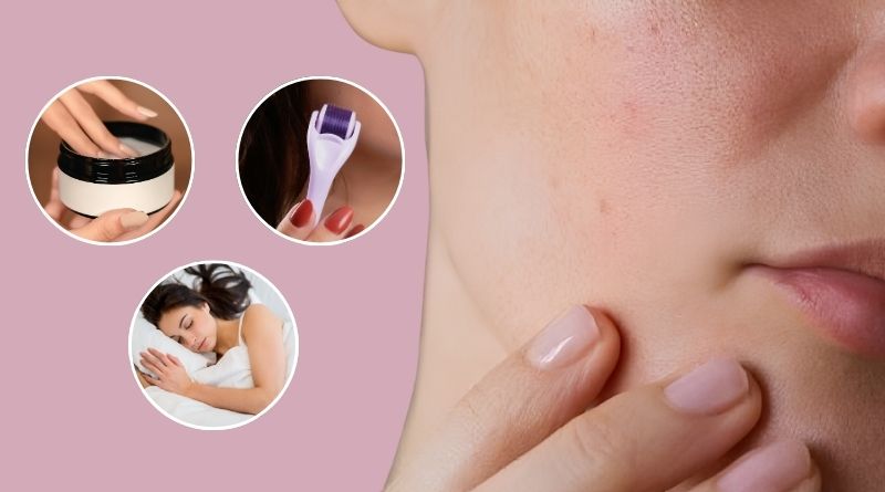 10 Cách phục hồi da mặt bị rỗ tại nhà cấp tốc
