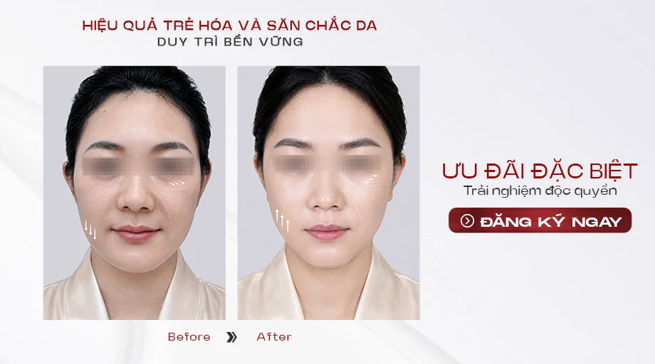 Liệu trình Shynh Density Lux tại Shynh Medical Clinic
