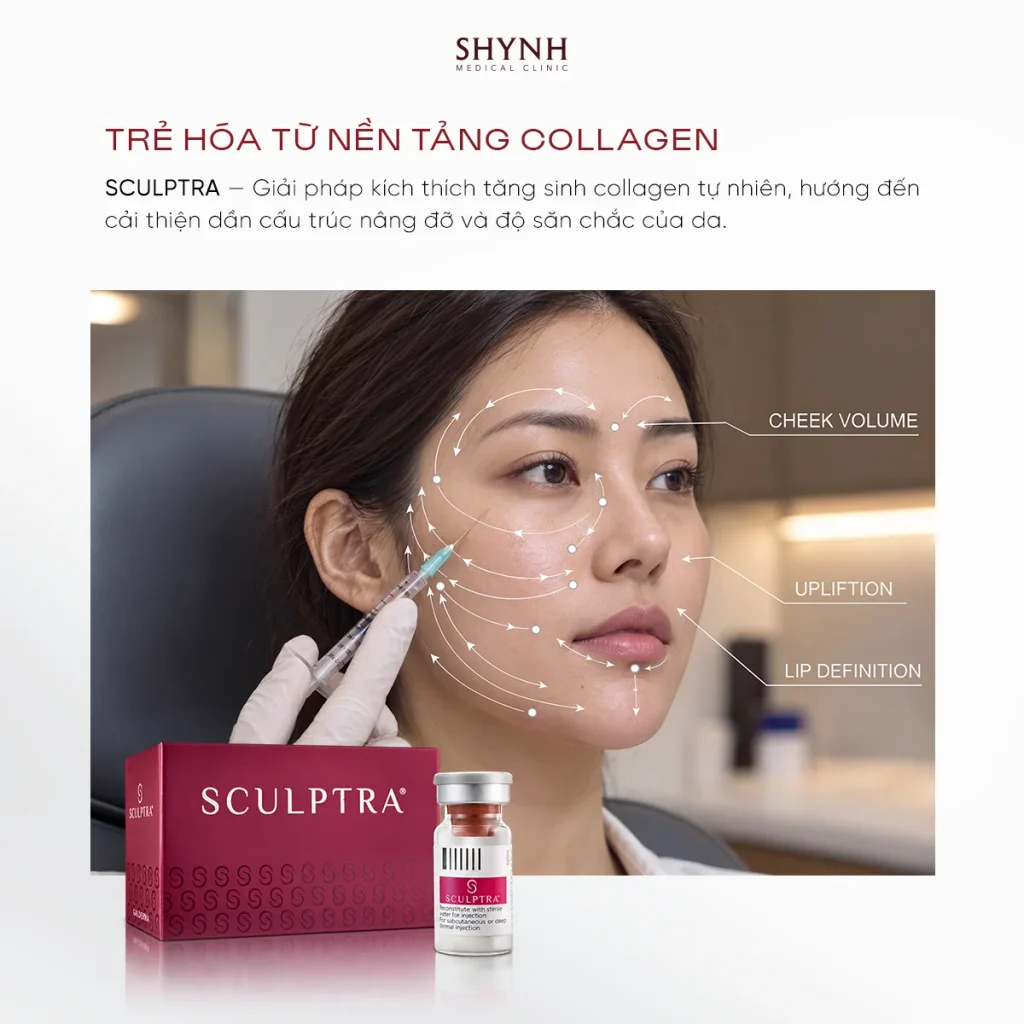 Tiêm Sculptra kích thích collagen tự nhiên hỗ trợ cải thiện cấu trúc gương mặt