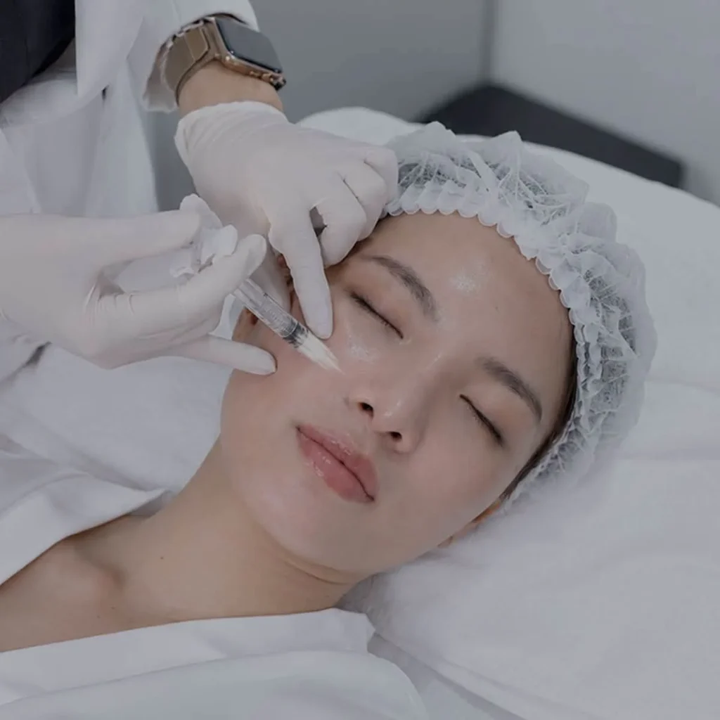 Baby Tox hỗ trợ cải thiện nếp nhăn biểu cảm tại Shynh Medical Clinic.