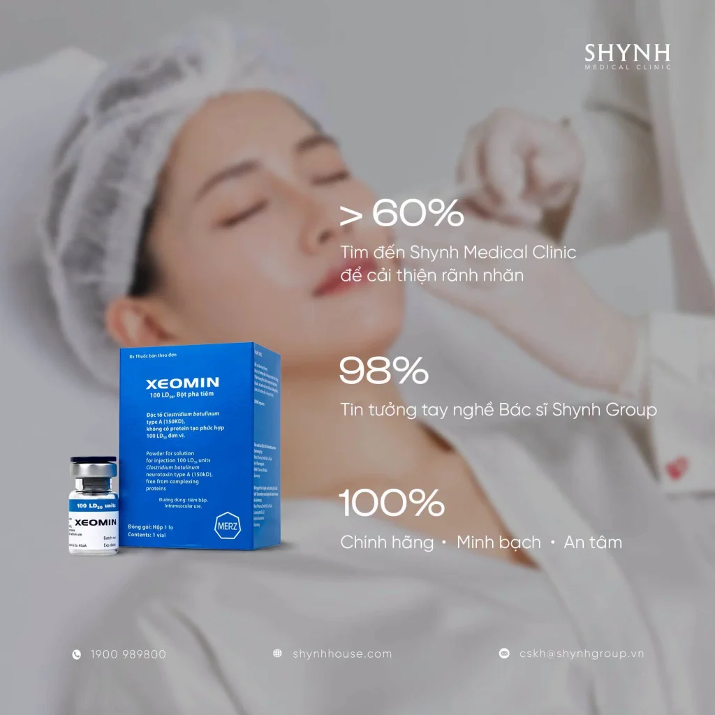 Botox hỗ trợ cải thiện nếp nhăn động vùng trán và đuôi mắt