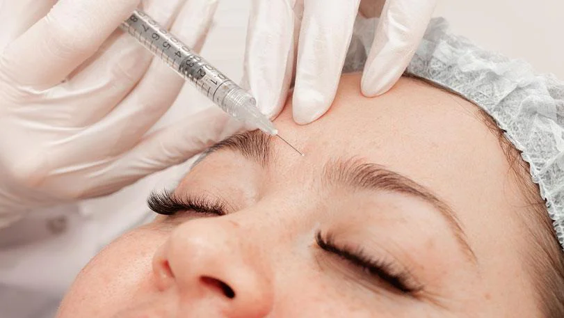 Các vùng gương mặt có thể được chỉ định tiêm Filler như môi má và cằm