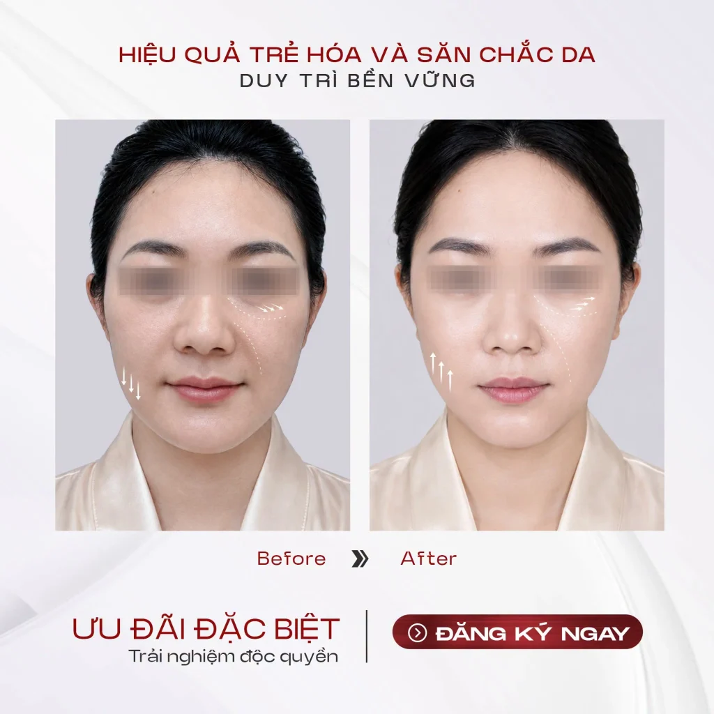 Bác sĩ tư vấn giải pháp trẻ hóa da tại Shynh Medical Clinic.