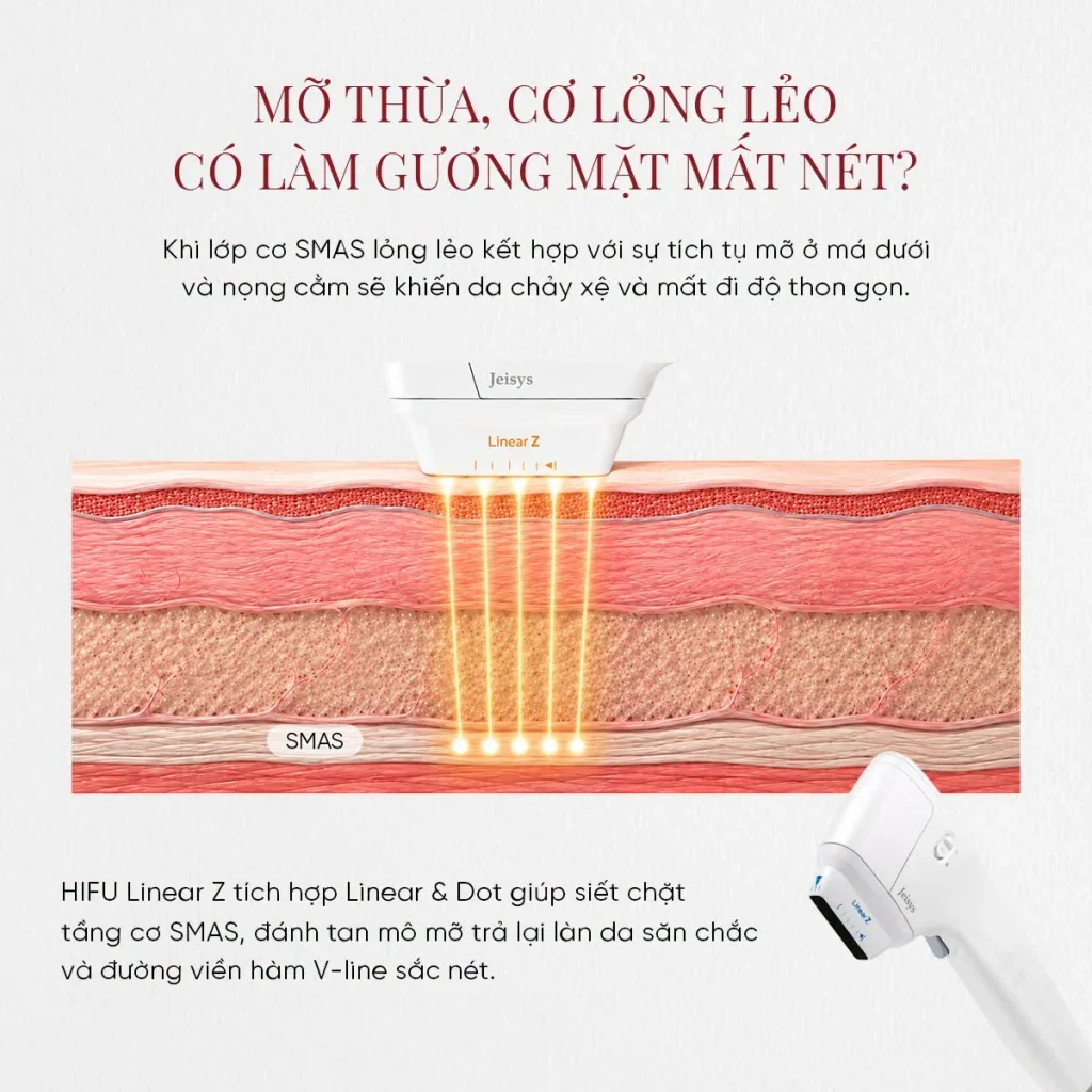 Công nghệ Hi-Trulift Pro ứng dụng HIFU hỗ trợ nâng cơ và cải thiện độ săn chắc da