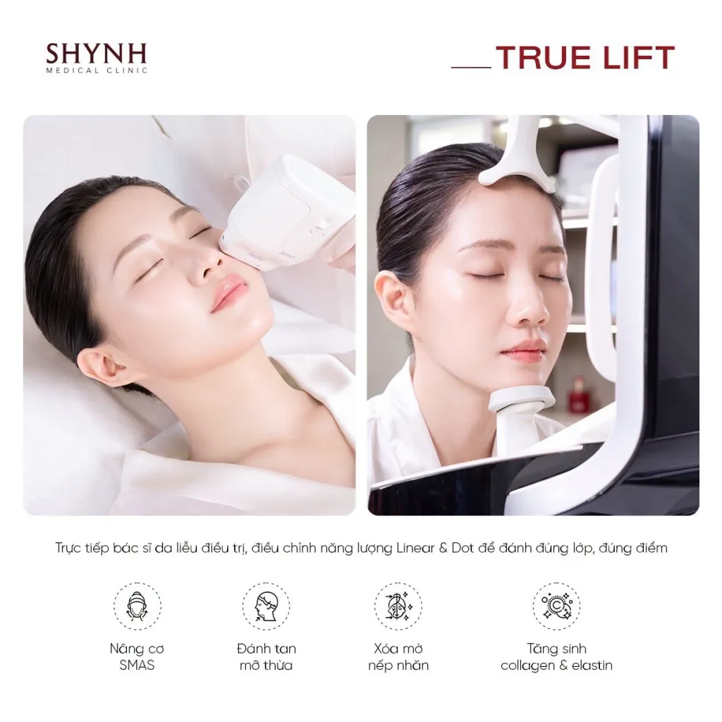 Các dấu hiệu lão hóa có thể được cân nhắc điều trị bằng Hi-Trulift Pro kết hợp Botox