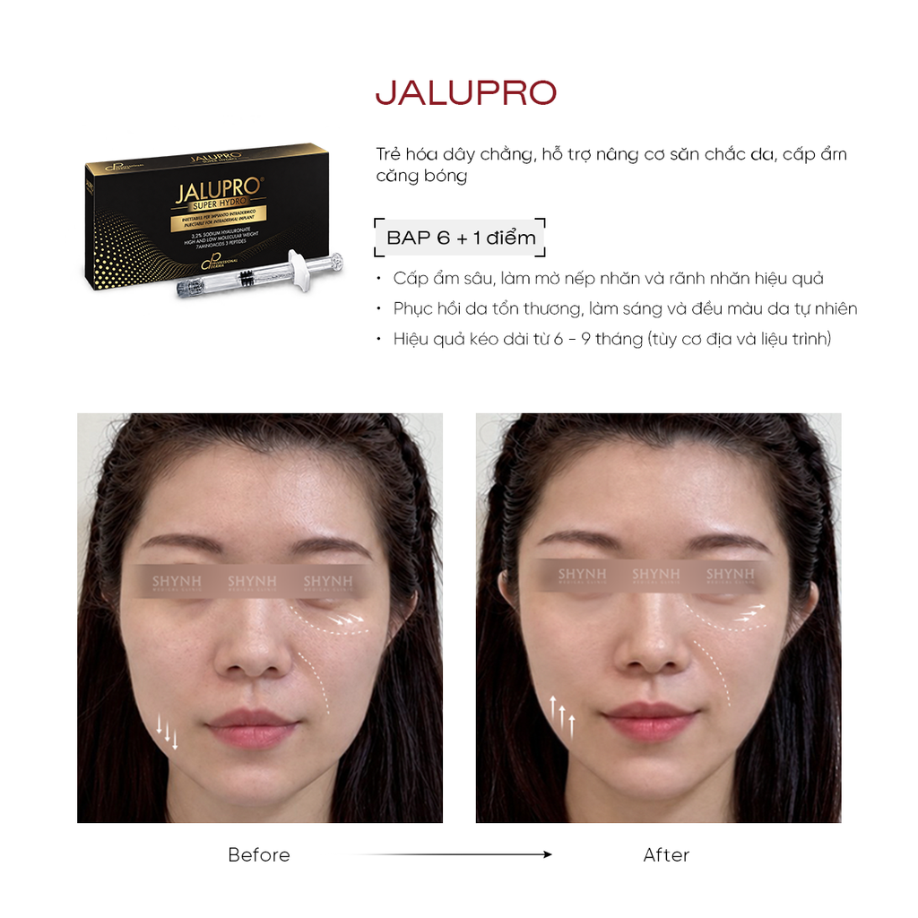 Jalupro kết hợp amino acid và hyaluronic acid cải thiện chất lượng da