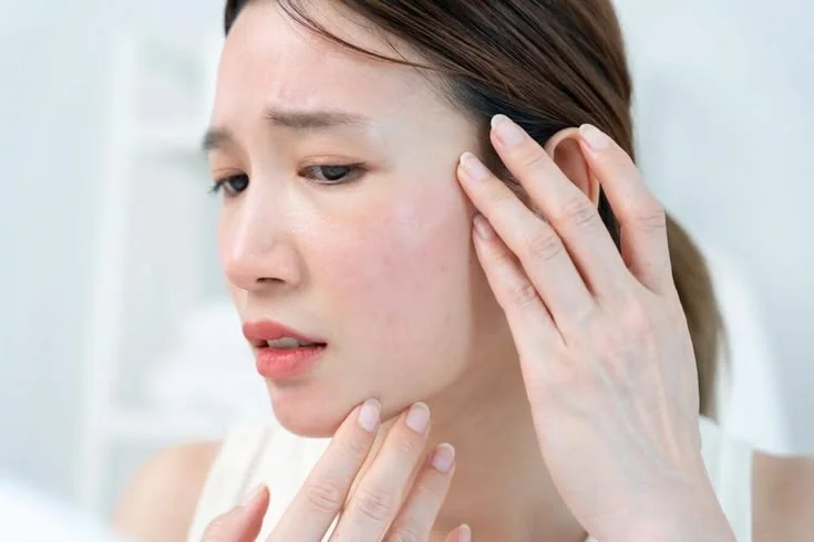 Đánh giá tình trạng sắc tố trước khi chăm sóc da nám